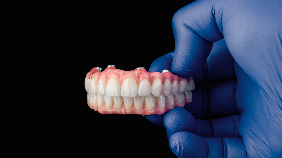 All-on-4 implantes — Smile Implant Center
